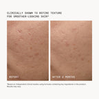 FacialRX™ Daily Peel Pads