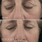 FacialRX™ Brightening Eye Masks